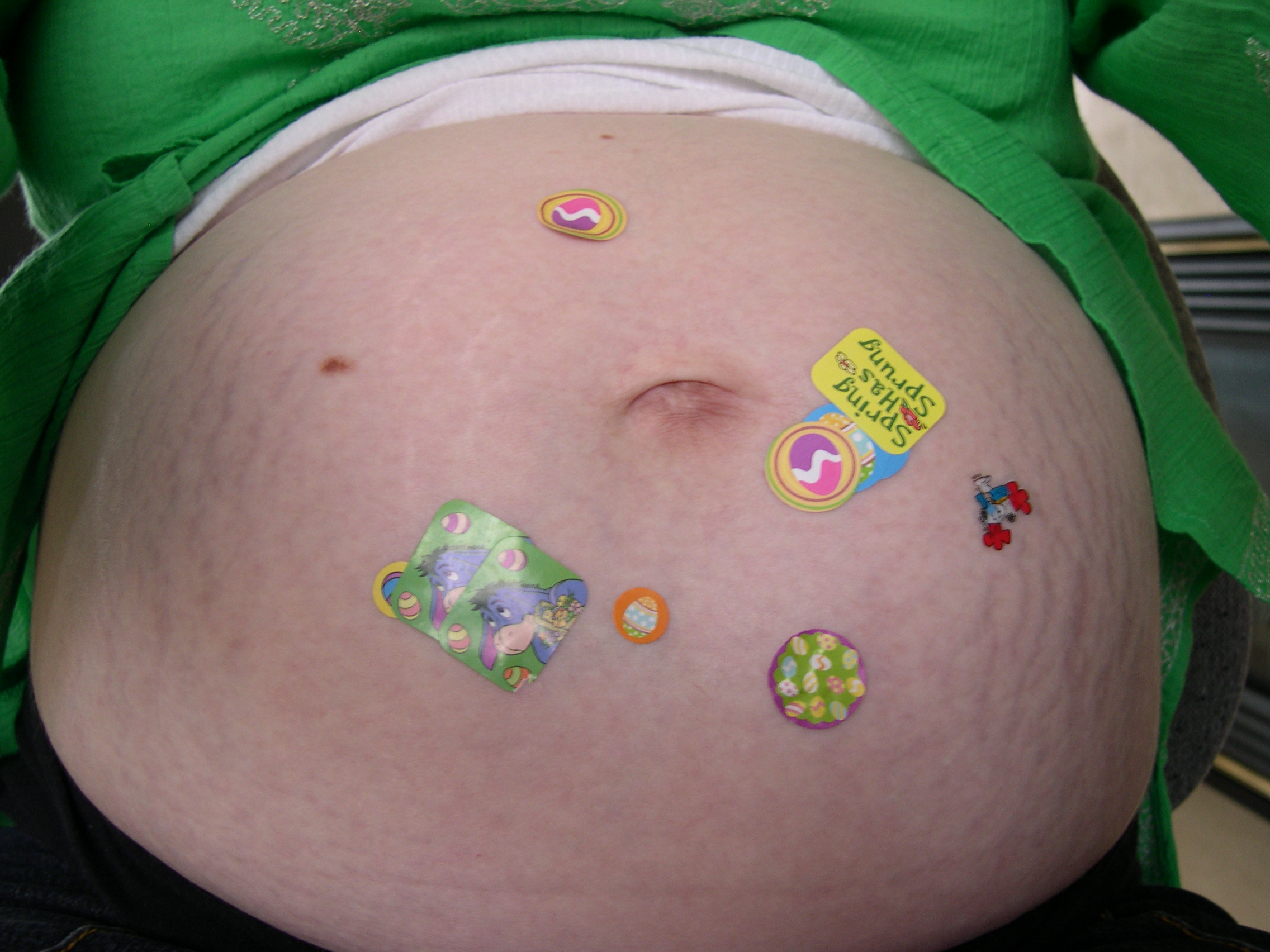 Nicky likes to put stickers on the belly!