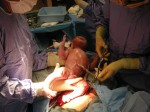 Cutting the umbilical cord